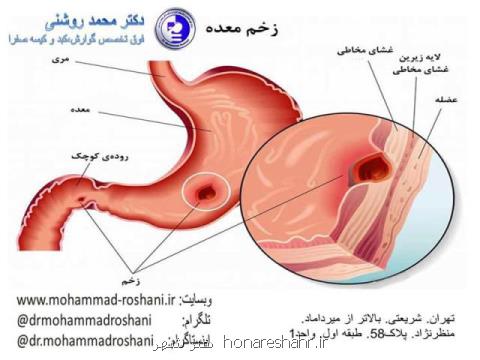 انجام آندوسكوپی و كولونوسكوپی